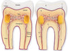 HUMAN TOOTH MODEL SOFT FOAM CROSS-SECTION TOOTH